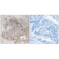 Rabbit Polyclonal Antibody to SPTBN5