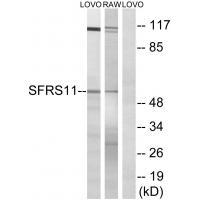 Rabbit Polyclonal Antibody to SFRS11