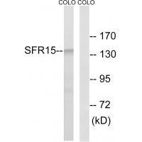 Rabbit Polyclonal Antibody to SFRS15