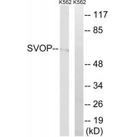 Rabbit Polyclonal Antibody to SVOP