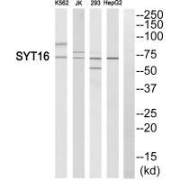 Rabbit Polyclonal Antibody to SYT16