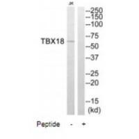 Rabbit Polyclonal Antibody to TBX18