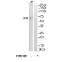 Rabbit Polyclonal Antibody to CD6