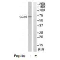 Rabbit Polyclonal Antibody to CCT5