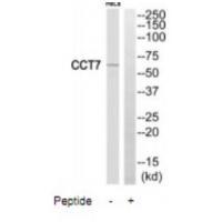 Rabbit Polyclonal Antibody to CCT7