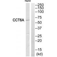 Rabbit Polyclonal Antibody to CCT6A