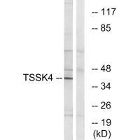 Rabbit Polyclonal Antibody to TSSK4