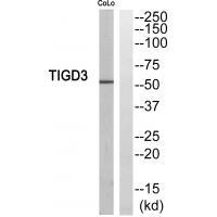 Rabbit Polyclonal Antibody to TIGD3