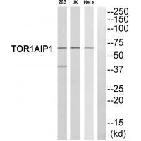 Rabbit Polyclonal Antibody to TOR1AIP1