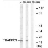 Rabbit Polyclonal Antibody to TRAPPC3