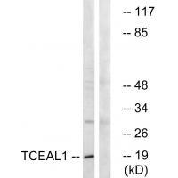 Rabbit Polyclonal Antibody to TCEAL1