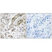 Rabbit Polyclonal Antibody to TCEAL3/5/6