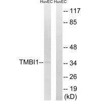 Rabbit Polyclonal Antibody to TMBIM1