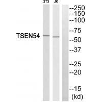 Rabbit Polyclonal Antibody to TSEN54