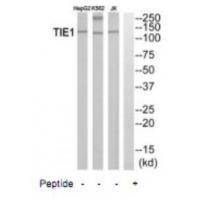 Rabbit Polyclonal Antibody to TIE1