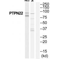 Rabbit Polyclonal Antibody to PTPN22