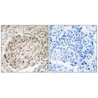 Rabbit Polyclonal Antibody to USP36