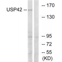 Rabbit Polyclonal Antibody to USP42