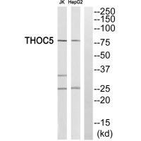 Rabbit Polyclonal Antibody to THOC5