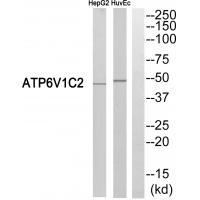 Rabbit Polyclonal Antibody to ATP6V1C2