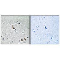 Rabbit Polyclonal Antibody to ATP6V1H
