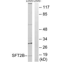 Rabbit Polyclonal Antibody to SFT2B