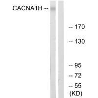 Rabbit Polyclonal Antibody to CACNA1H