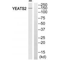 Rabbit Polyclonal Antibody to YEATS2