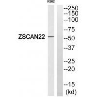 Rabbit Polyclonal Antibody to ZSCAN22