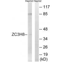 Rabbit Polyclonal Antibody to ZC3H8