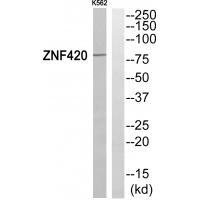 Rabbit Polyclonal Antibody to ZNF42