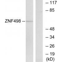 Rabbit Polyclonal Antibody to ZNF498