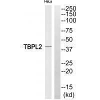 Rabbit Polyclonal Antibody to TBPL2