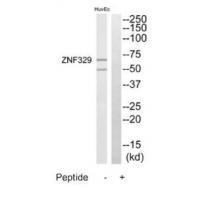 Rabbit Polyclonal Antibody to ZNF329