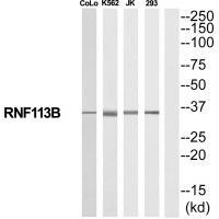 Rabbit Polyclonal Antibody to RNF113B