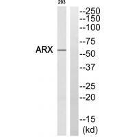 Rabbit Polyclonal Antibody to ARX