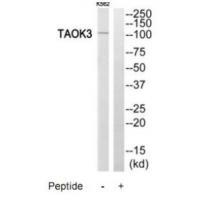 Rabbit Polyclonal Antibody to TAOK3