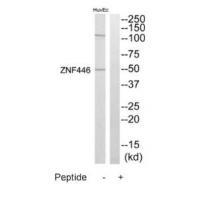 Rabbit Polyclonal Antibody to ZNF446