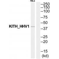 Rabbit Polyclonal Antibody to KITH_HHV1