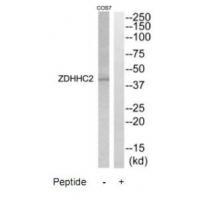 Rabbit Polyclonal Antibody to ZDHHC2