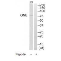 Rabbit Polyclonal Antibody to GNE
