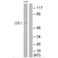Rabbit Polyclonal Antibody to CDY1