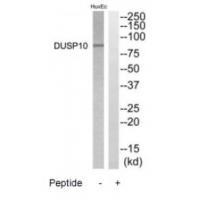 Rabbit Polyclonal Antibody to DGKB
