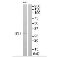 Rabbit Polyclonal Antibody to IFI6