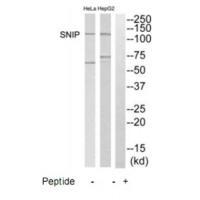 Rabbit Polyclonal Antibody to SNIP