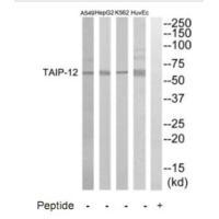 Rabbit Polyclonal Antibody to TAIP-12