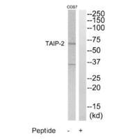 Rabbit Polyclonal Antibody to TAIP-2