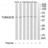 Rabbit Polyclonal Antibody to TUBA3C/E