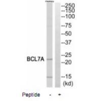 Rabbit Polyclonal Antibody to BCL7A