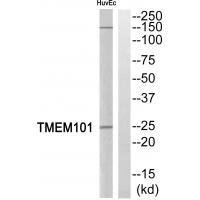 Rabbit Polyclonal Antibody to TMEM101